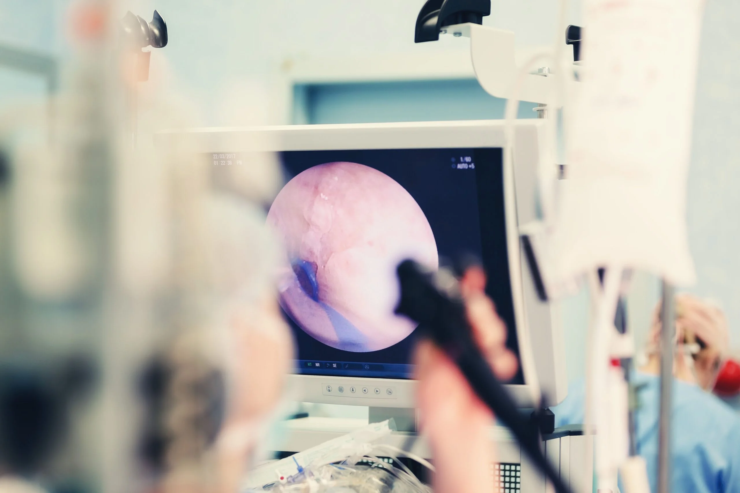 o exame de endoscopia serve para avaliar de perto os tecidos dos órgãos vitais da digestão